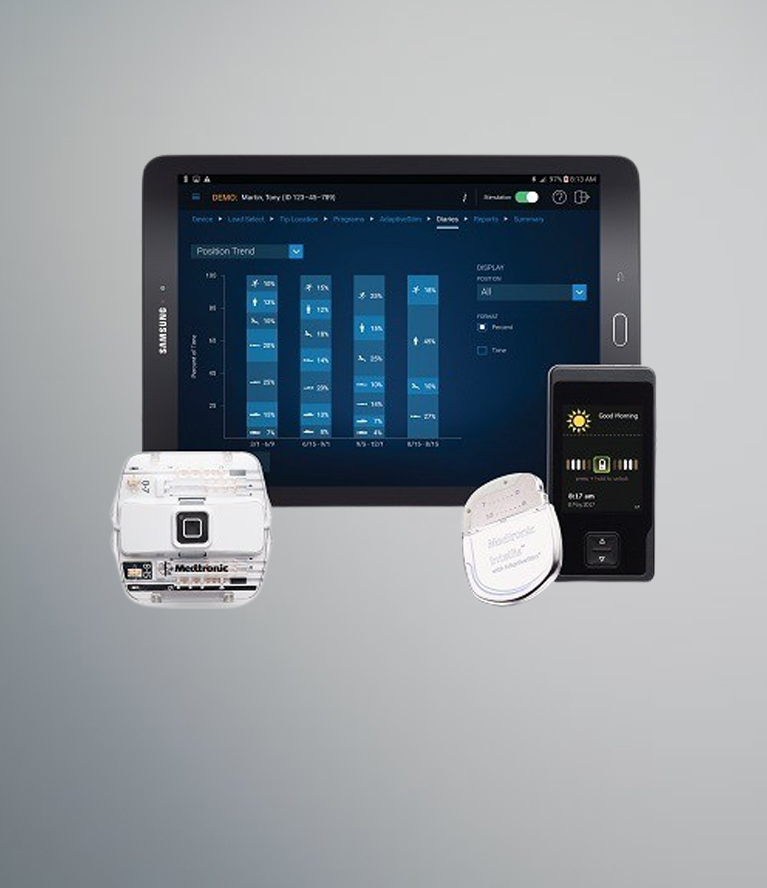 SPINAL CORD STIMULATION