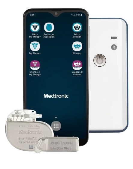 SACRAL NERVE STIMULATION in neuroaxis